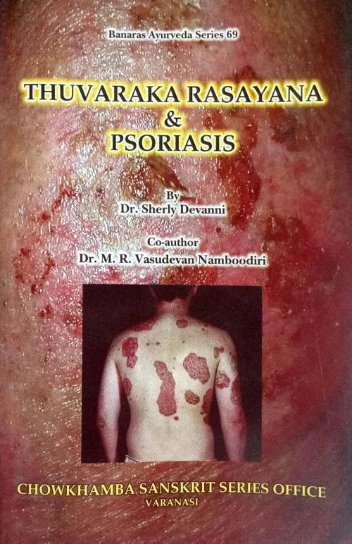 Thuvaraka Rasayan & Psoriasis